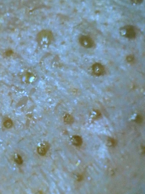 HILNON洗顔 使用前の毛穴状態