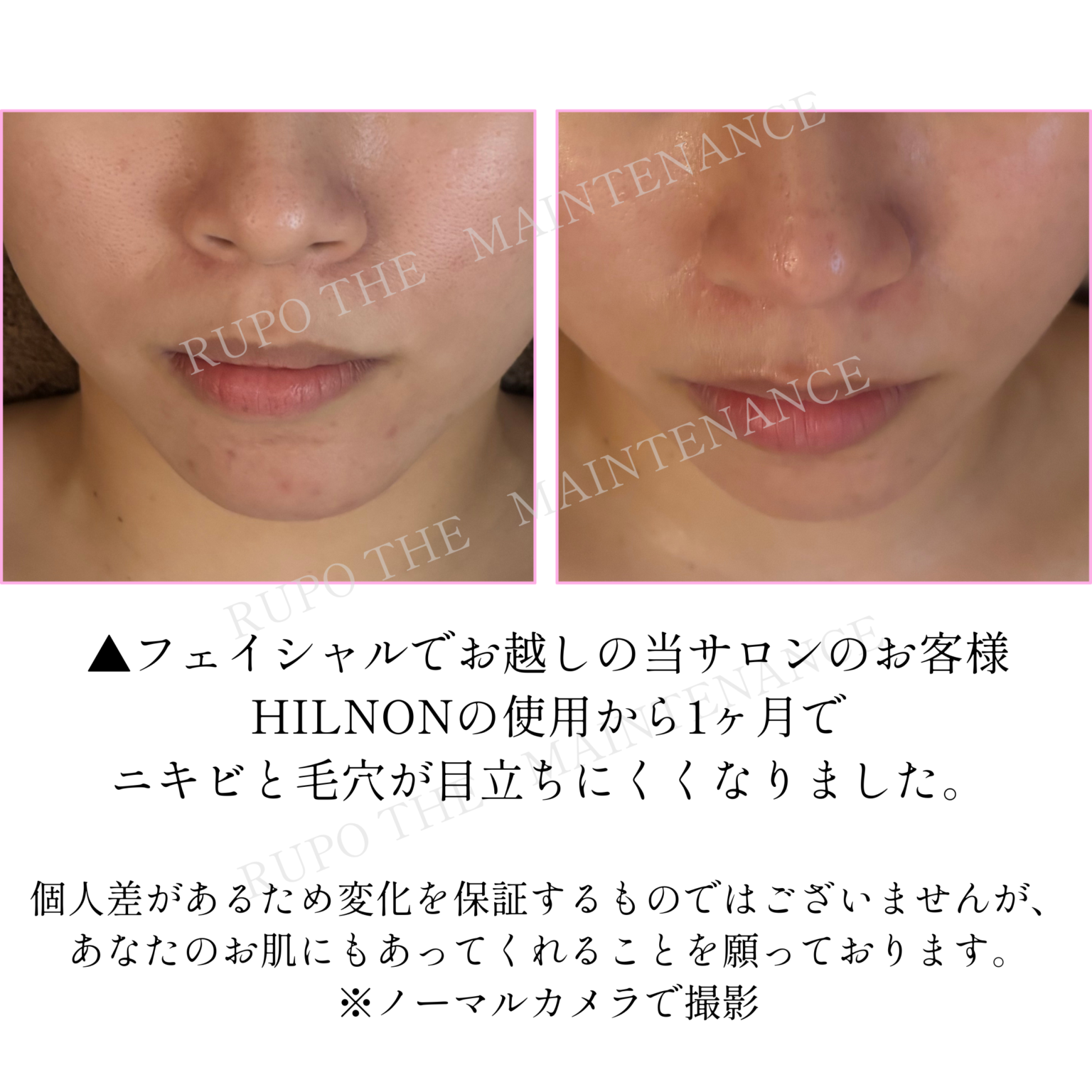 ビフォーアフター写真